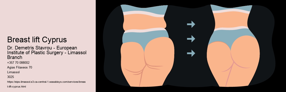 Breast lift Cyprus