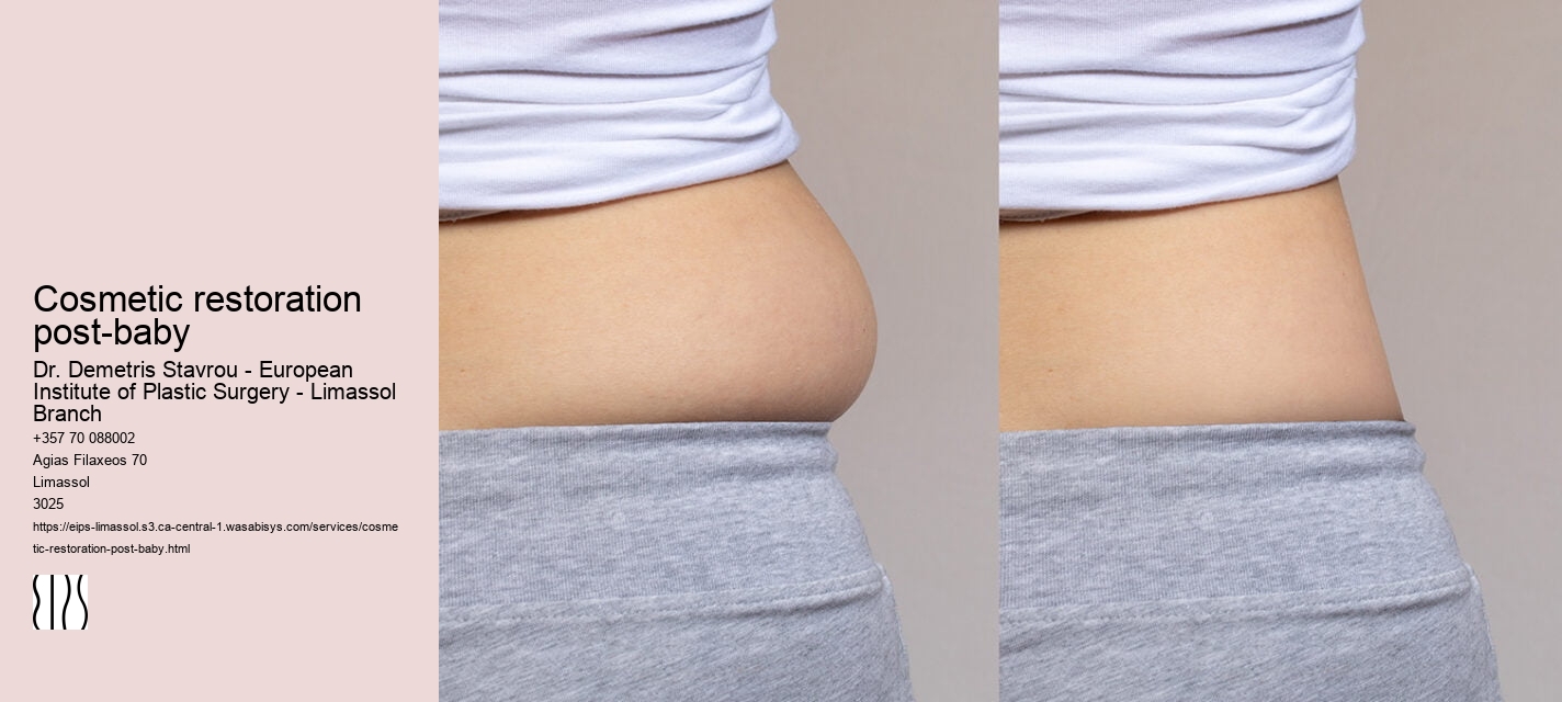 Cosmetic restoration post-baby