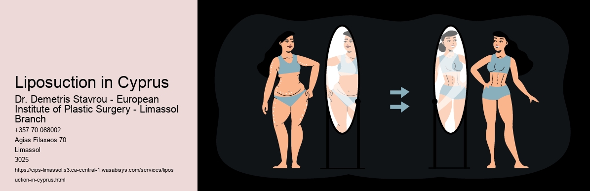 Liposuction in Cyprus