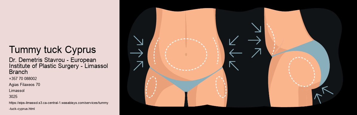 Tummy tuck Cyprus